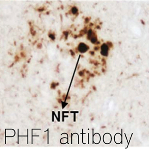 Antibody