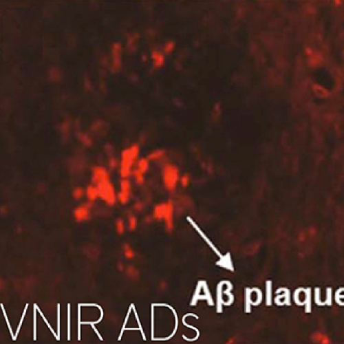 VNIR Ads